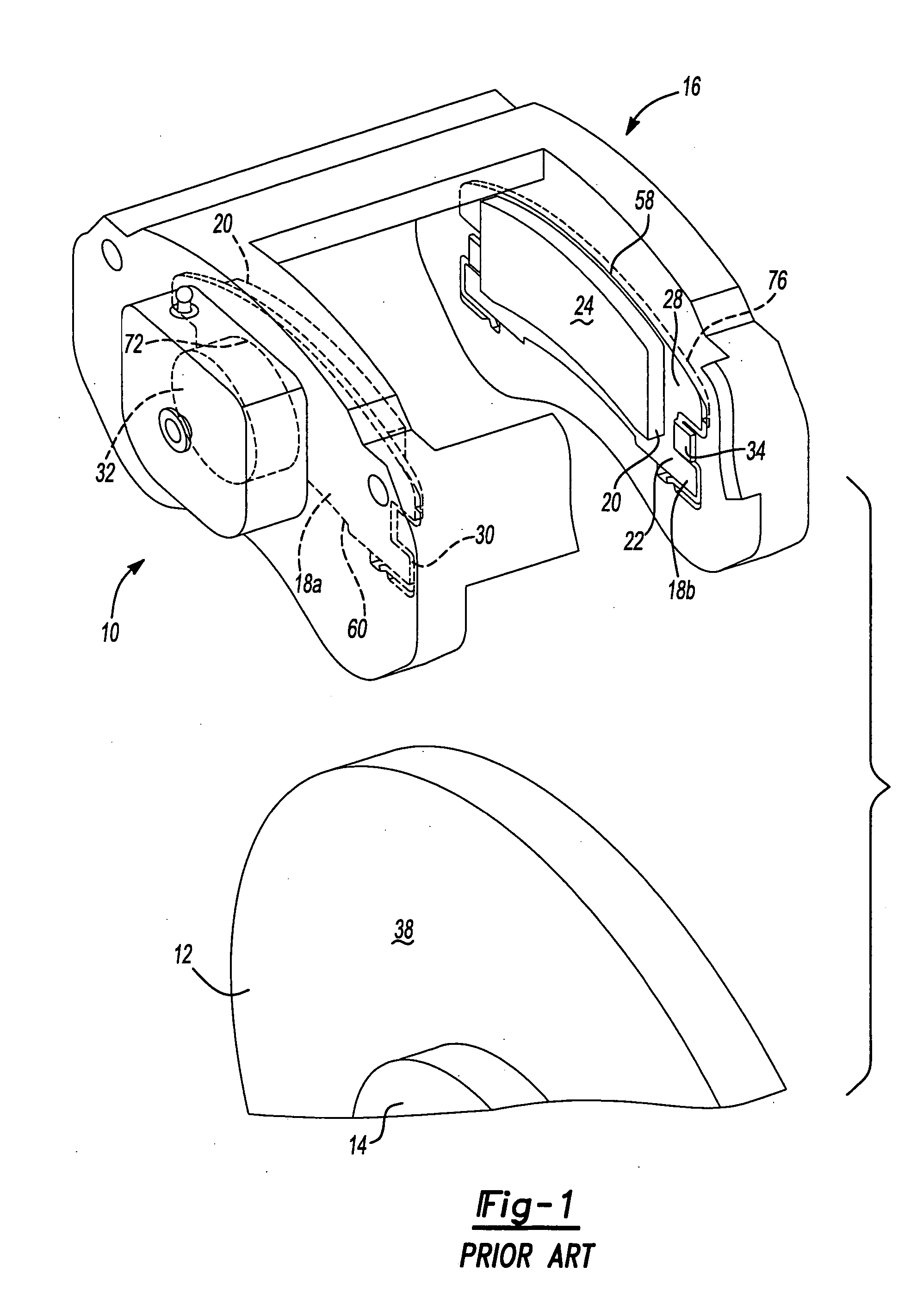 Pad retaining clips