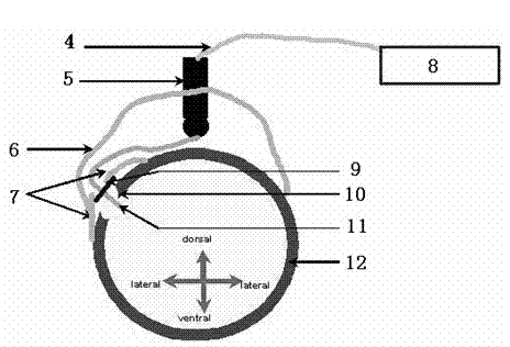 Rat primary auditory cortex microelectrode array implantation fixation operation method