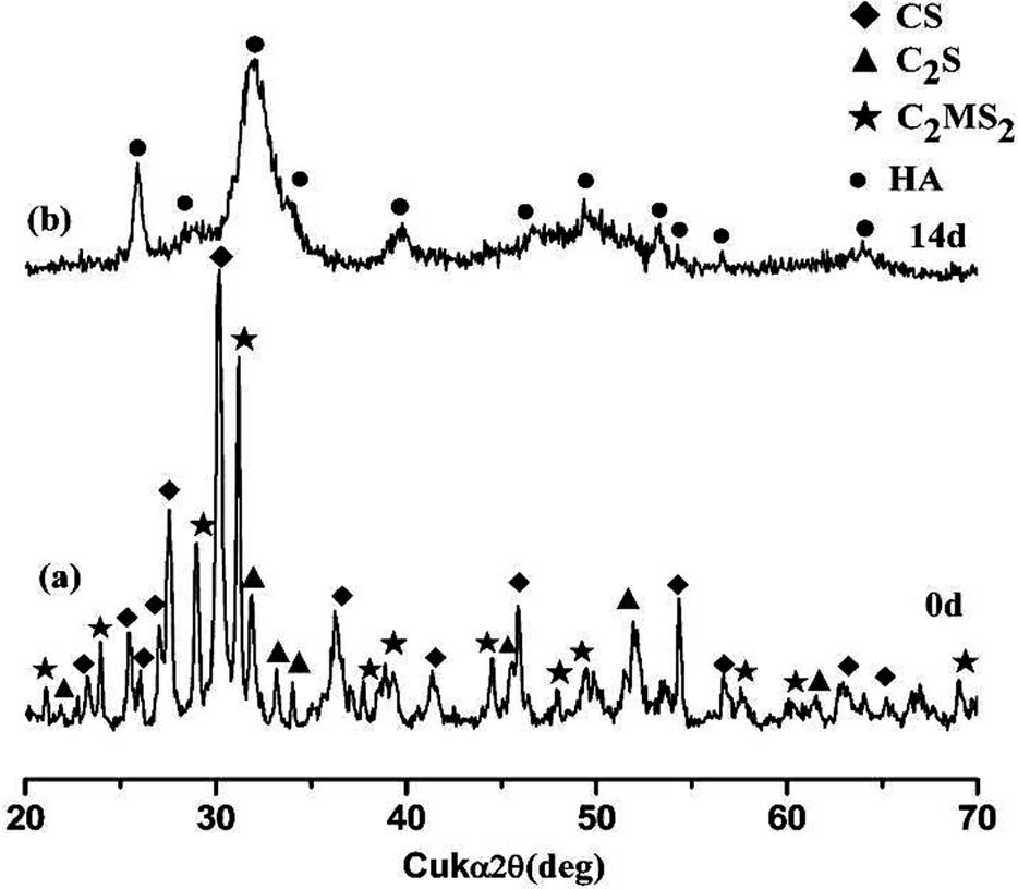 Preparation method of calcium-magnesium-silicon multiphase ceramic coating for titanium-based artificial joint handle