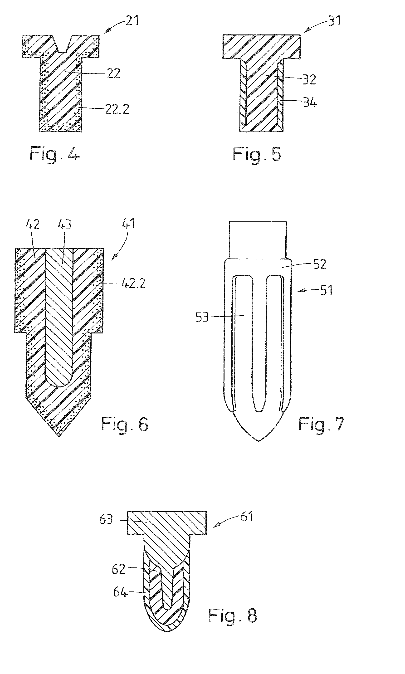 Implant, method of preparing an implant, implantation method, and kit of parts