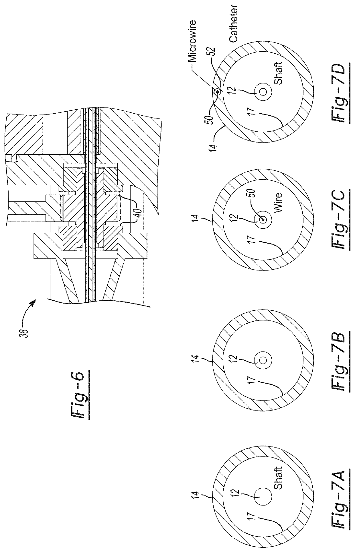 Hydrodynamic vortex aspiration catheter