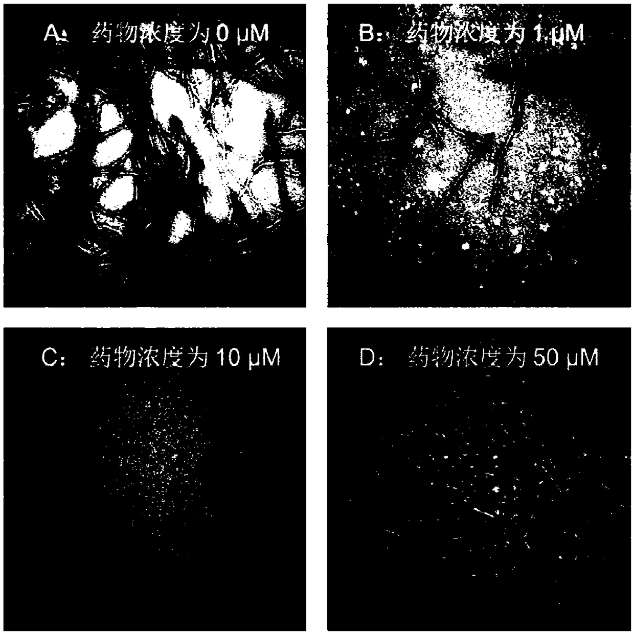 Application of psoralen B in inhibiting abnormal aggregation of Tau protein