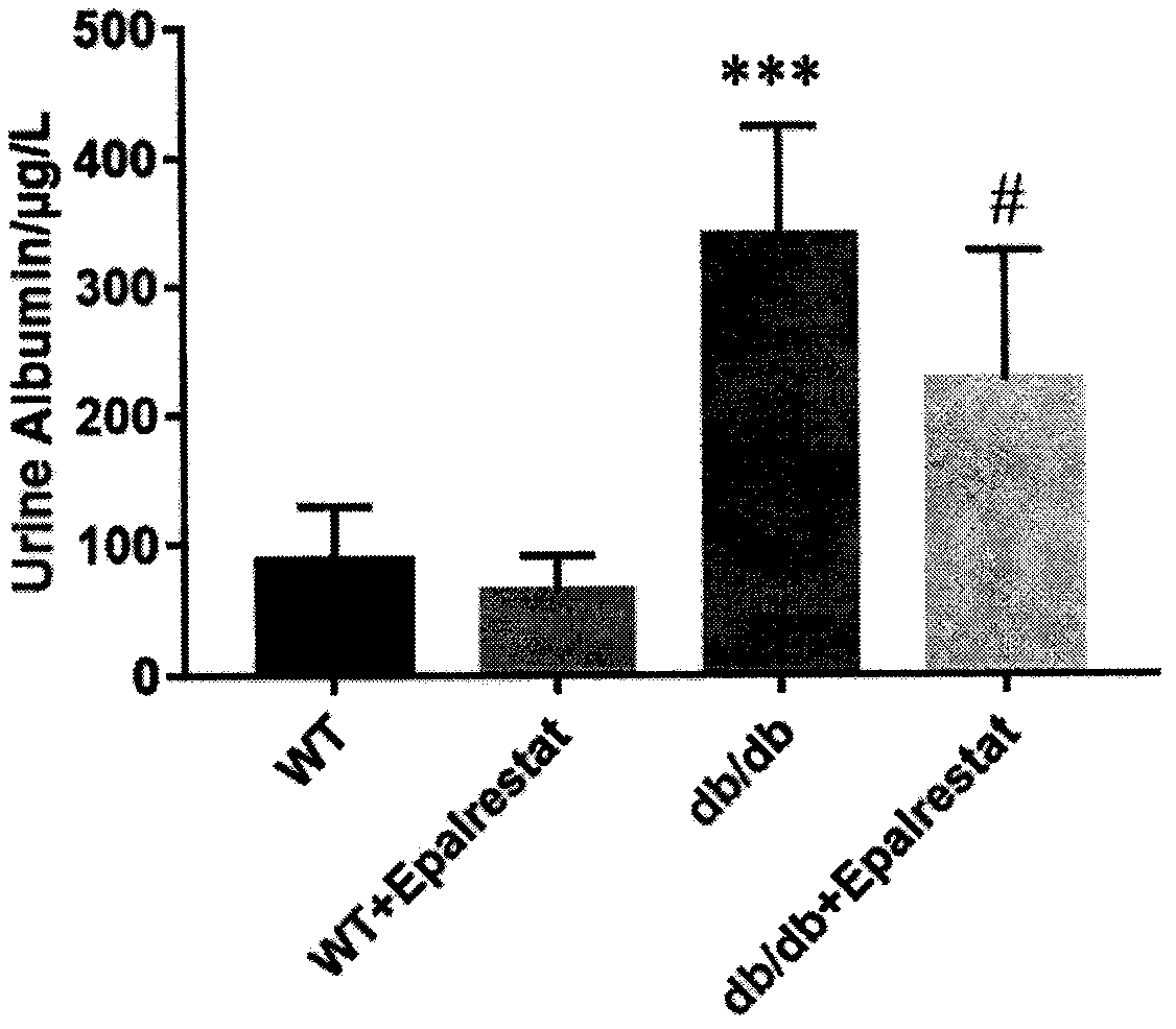 Application of epalrestat in preparation of drug for treating diabetic nephropathy