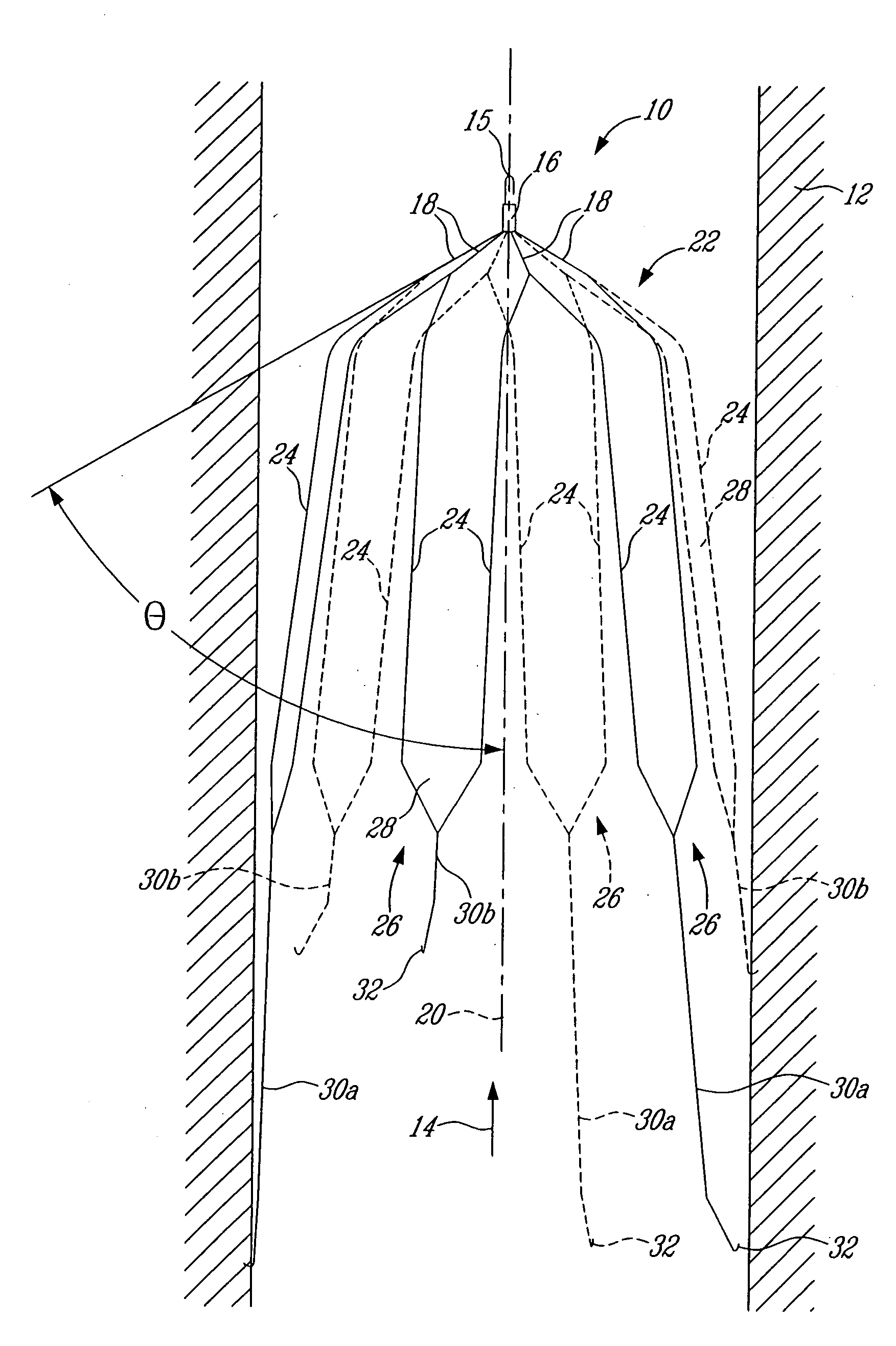 Embolus blood clot filter