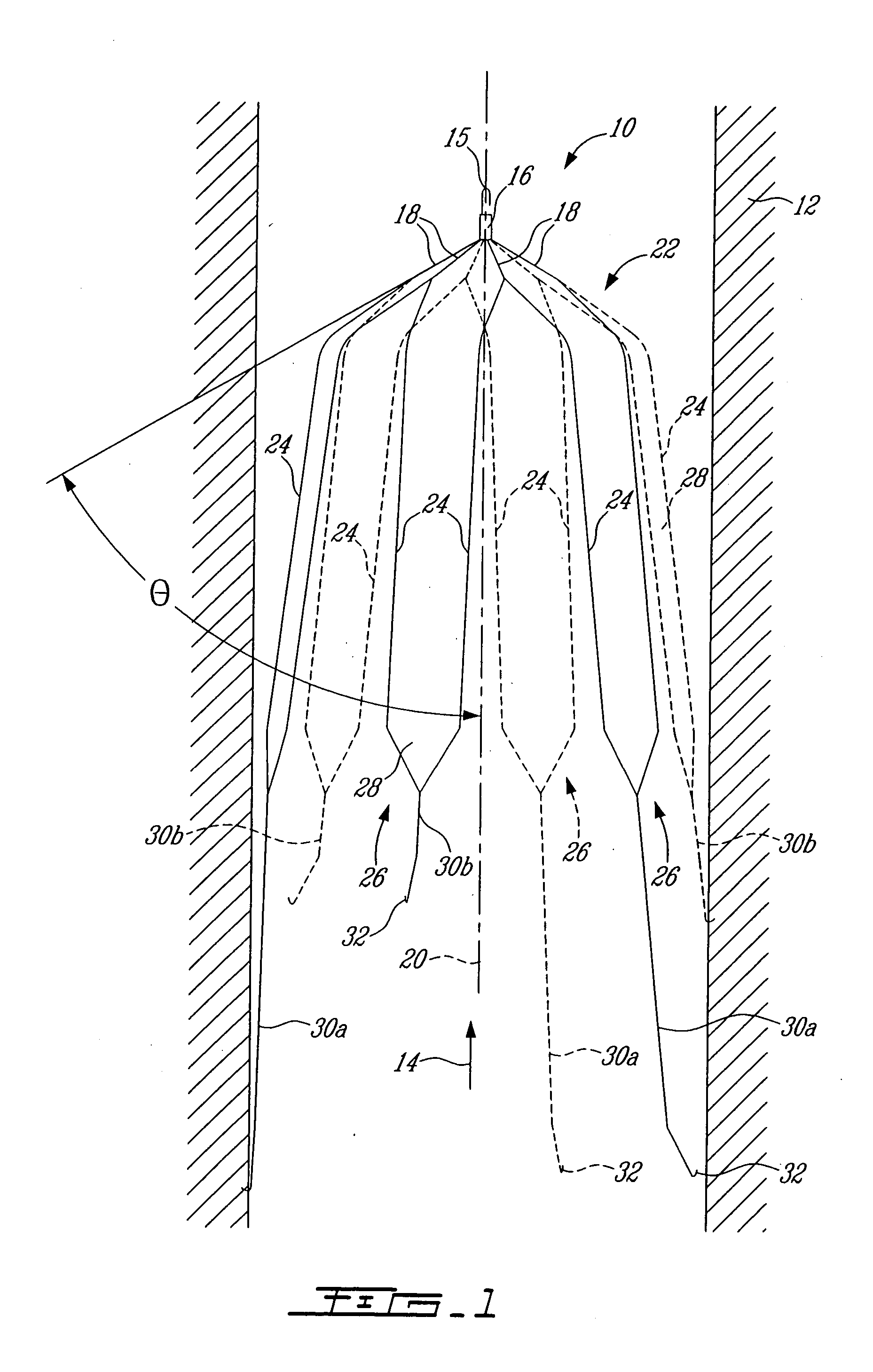 Embolus blood clot filter