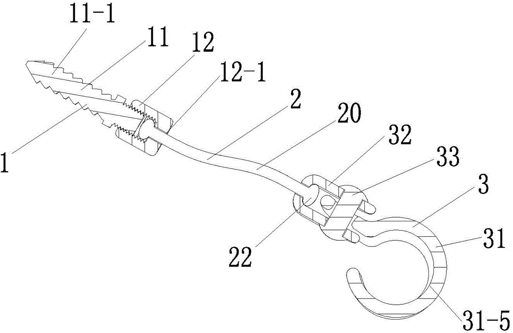 Lateral pharyngeal wall traction device and implantation method