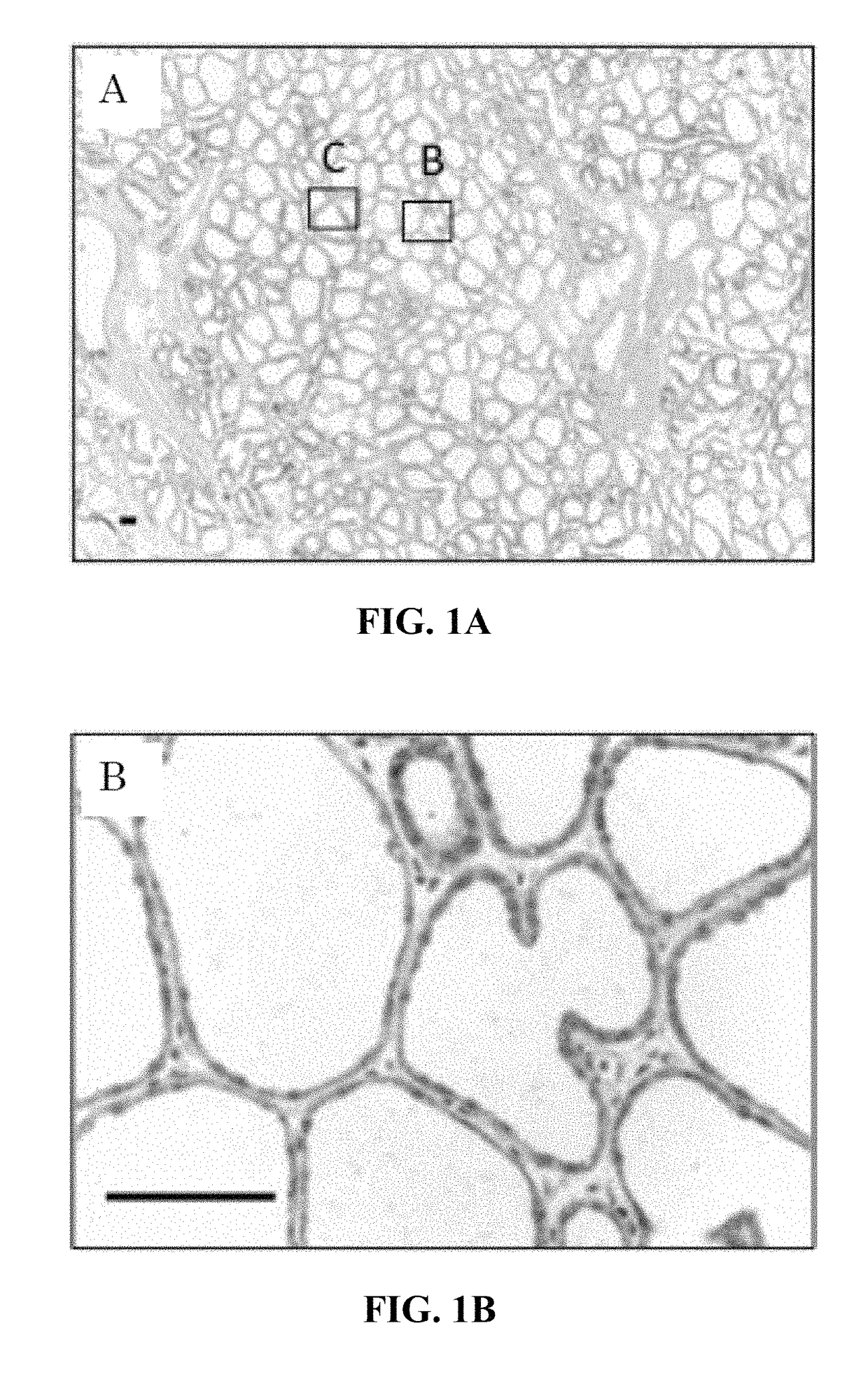 Detection method of mammary gland disease