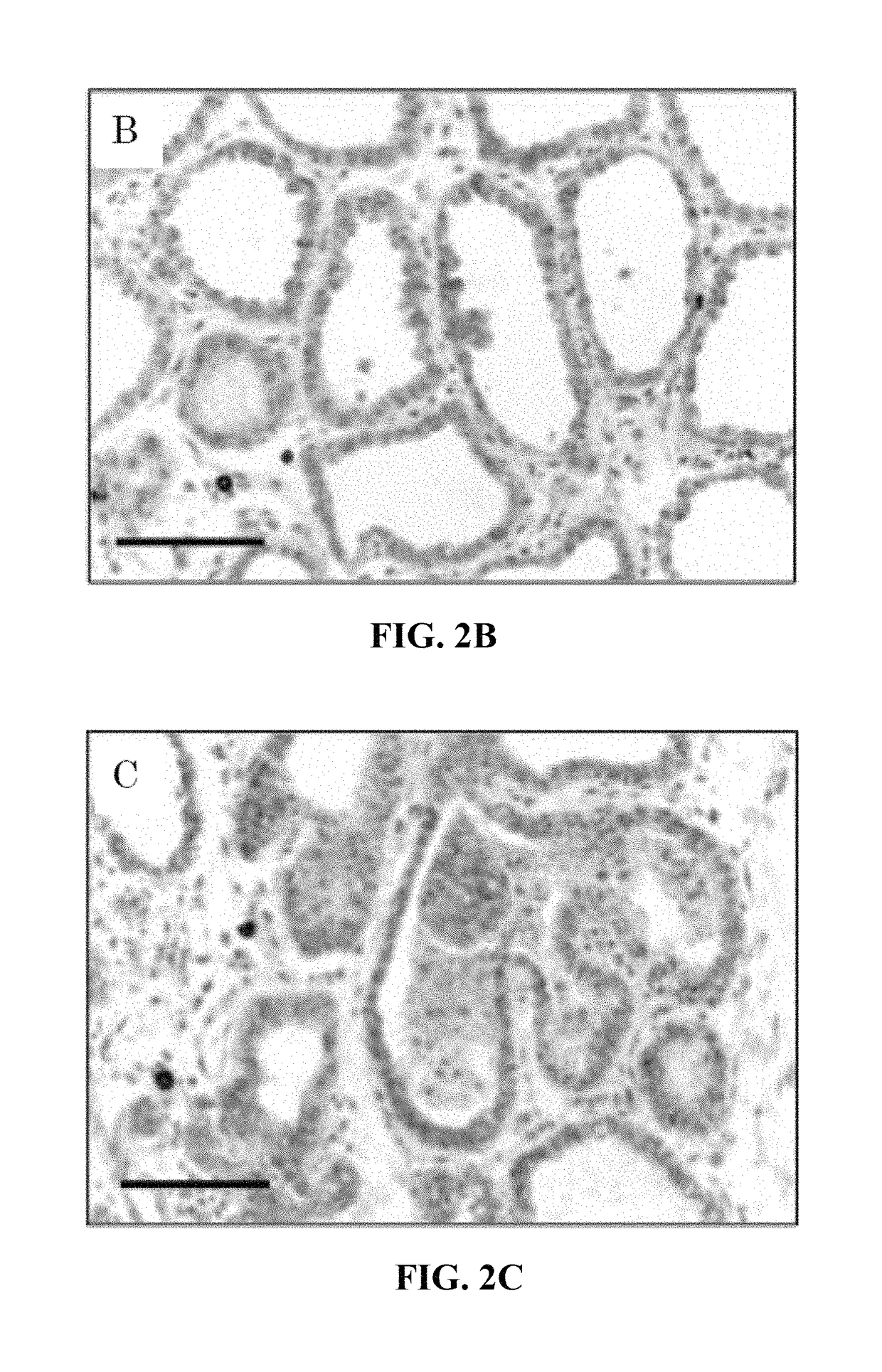 Detection method of mammary gland disease