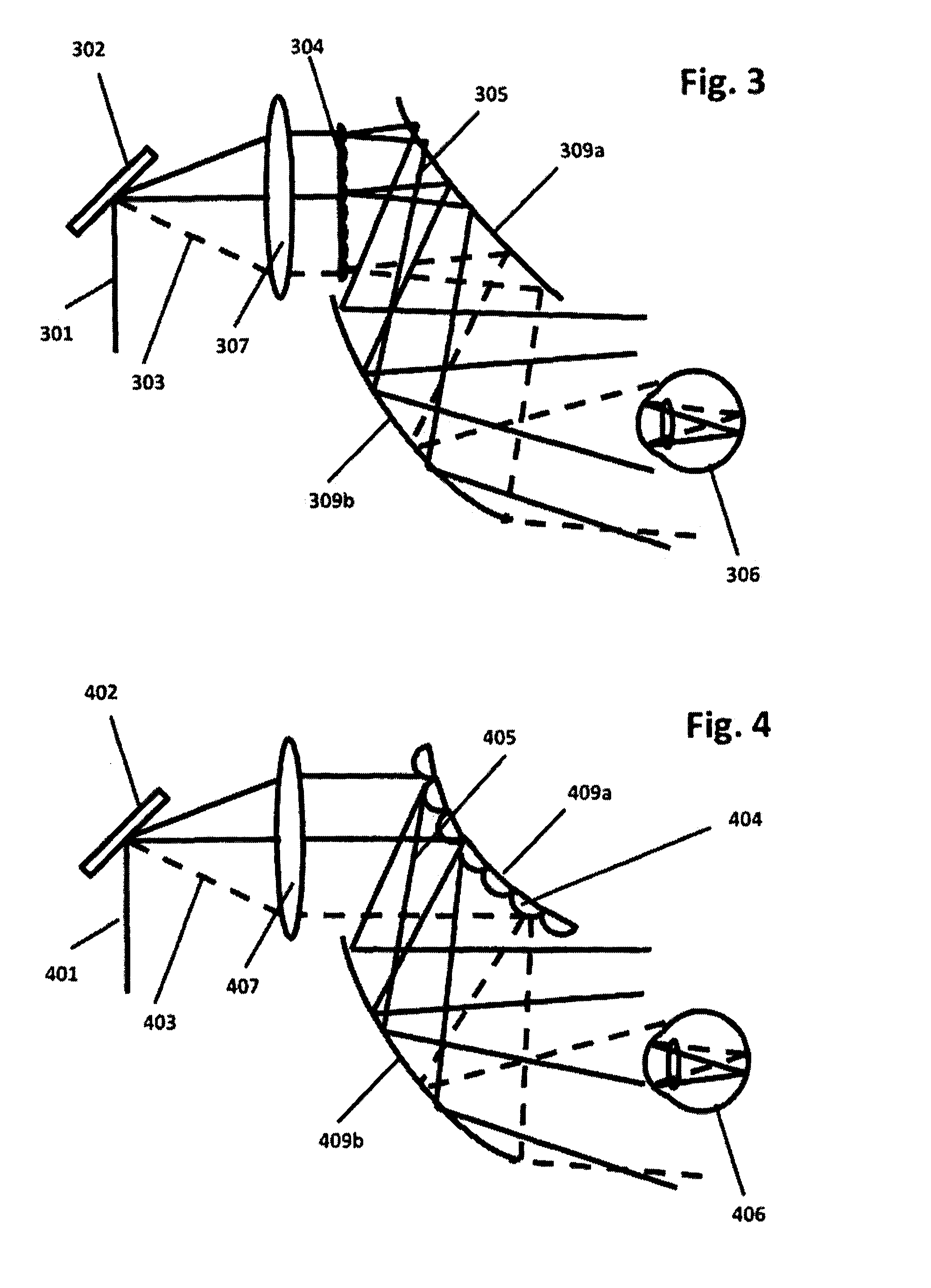 Speckle free laser projection