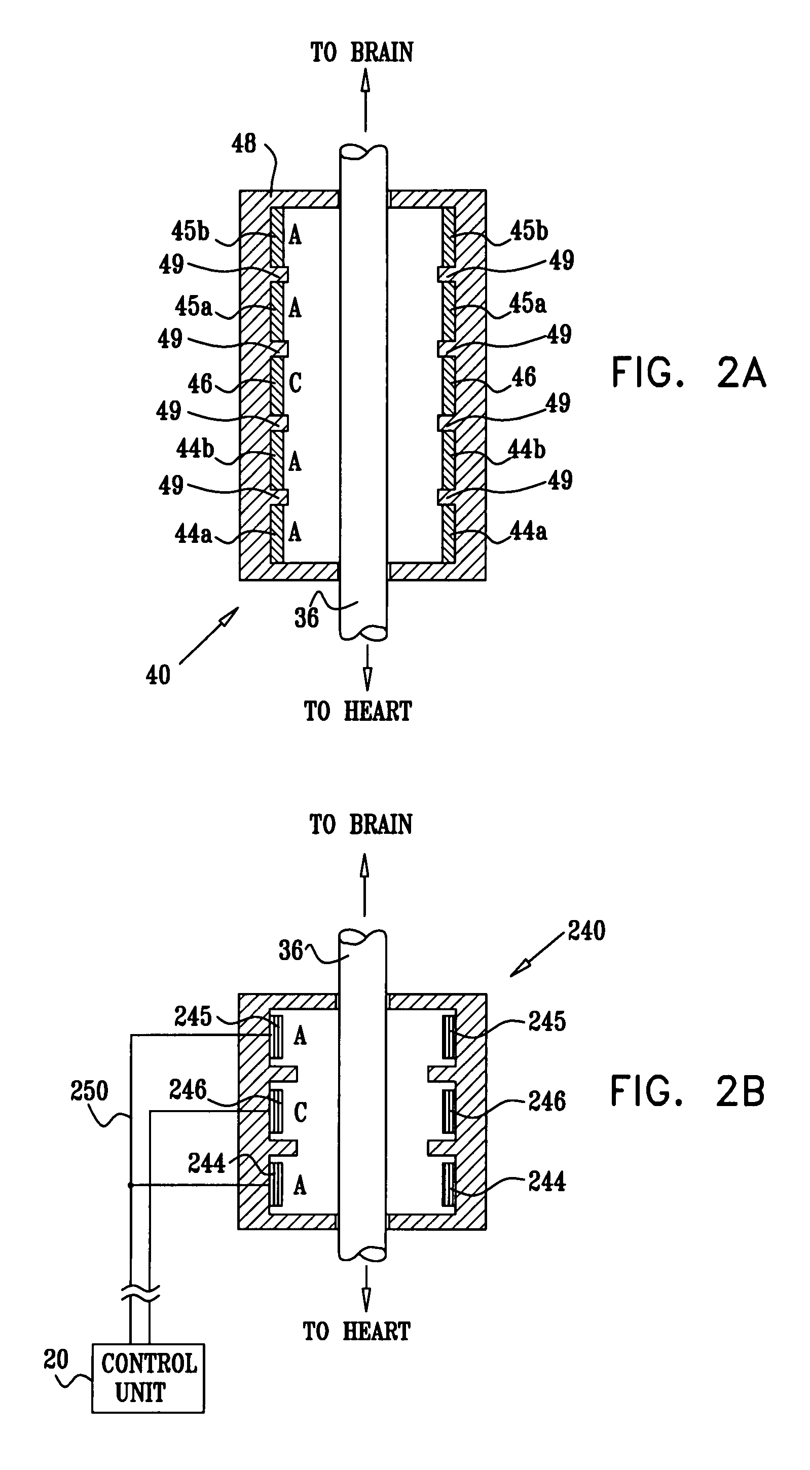 Intermittent electrical stimulation