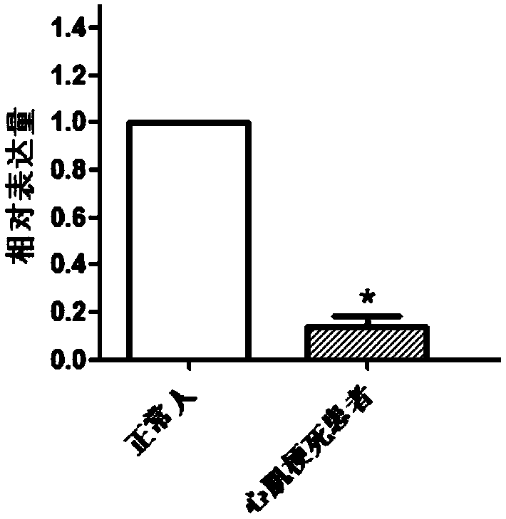 DOCK10 gene for early diagnosis of myocardial infarction