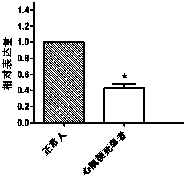 DOCK10 gene for early diagnosis of myocardial infarction