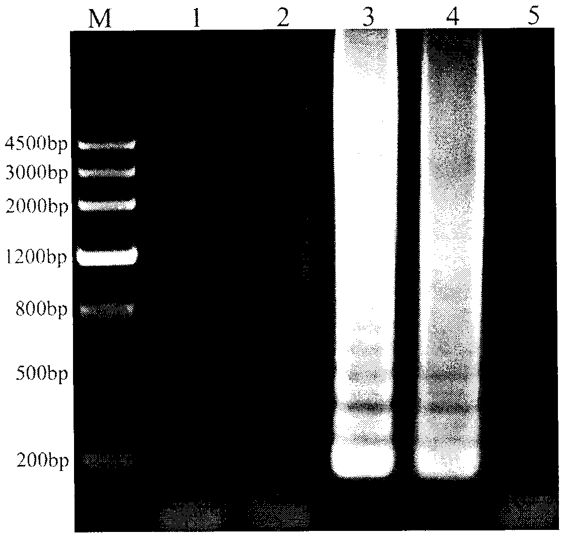 Technology for rapidly detecting rice black-streaked dwarf viruses in plants by reverse transcription-loop-mediated isothermal amplification (RT-LAMP) method