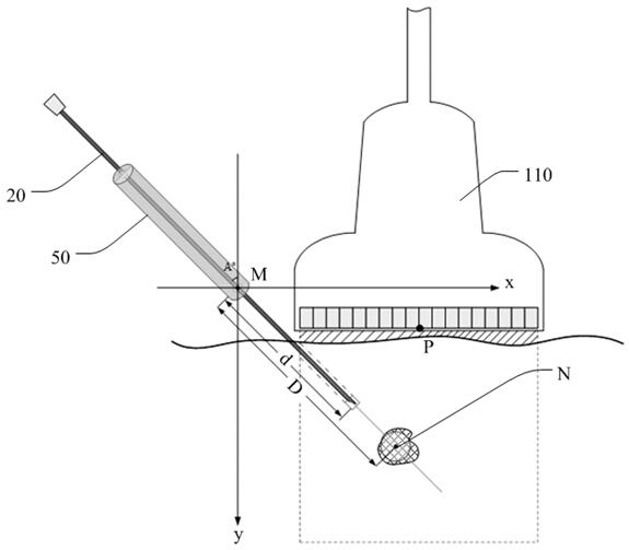 Puncture device, ultrasonic imaging equipment and auxiliary puncture method