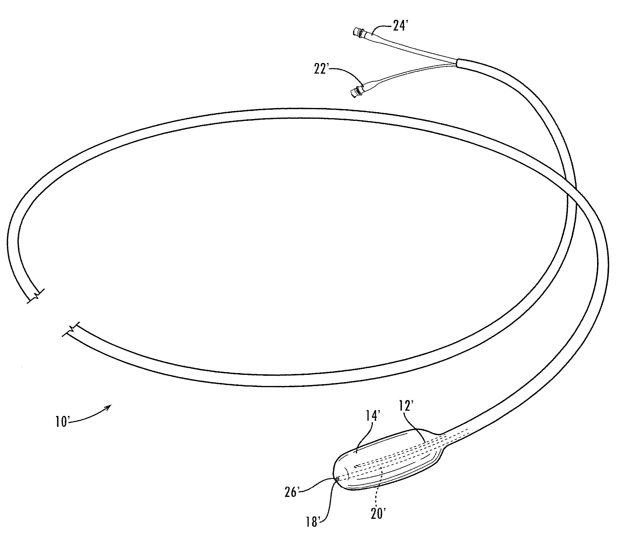 Apparatus and method for displacing tissue obstructions