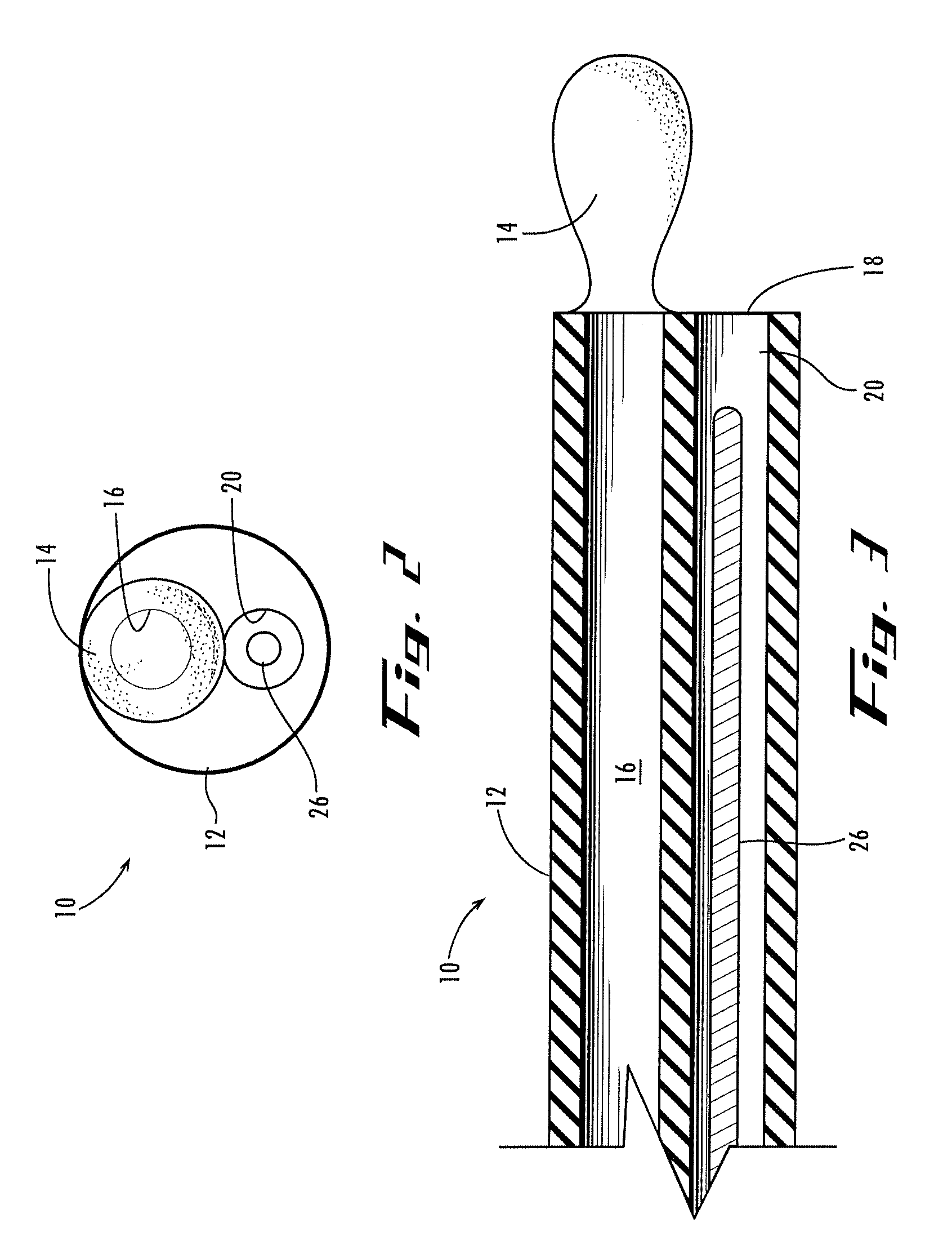 Apparatus and method for displacing tissue obstructions