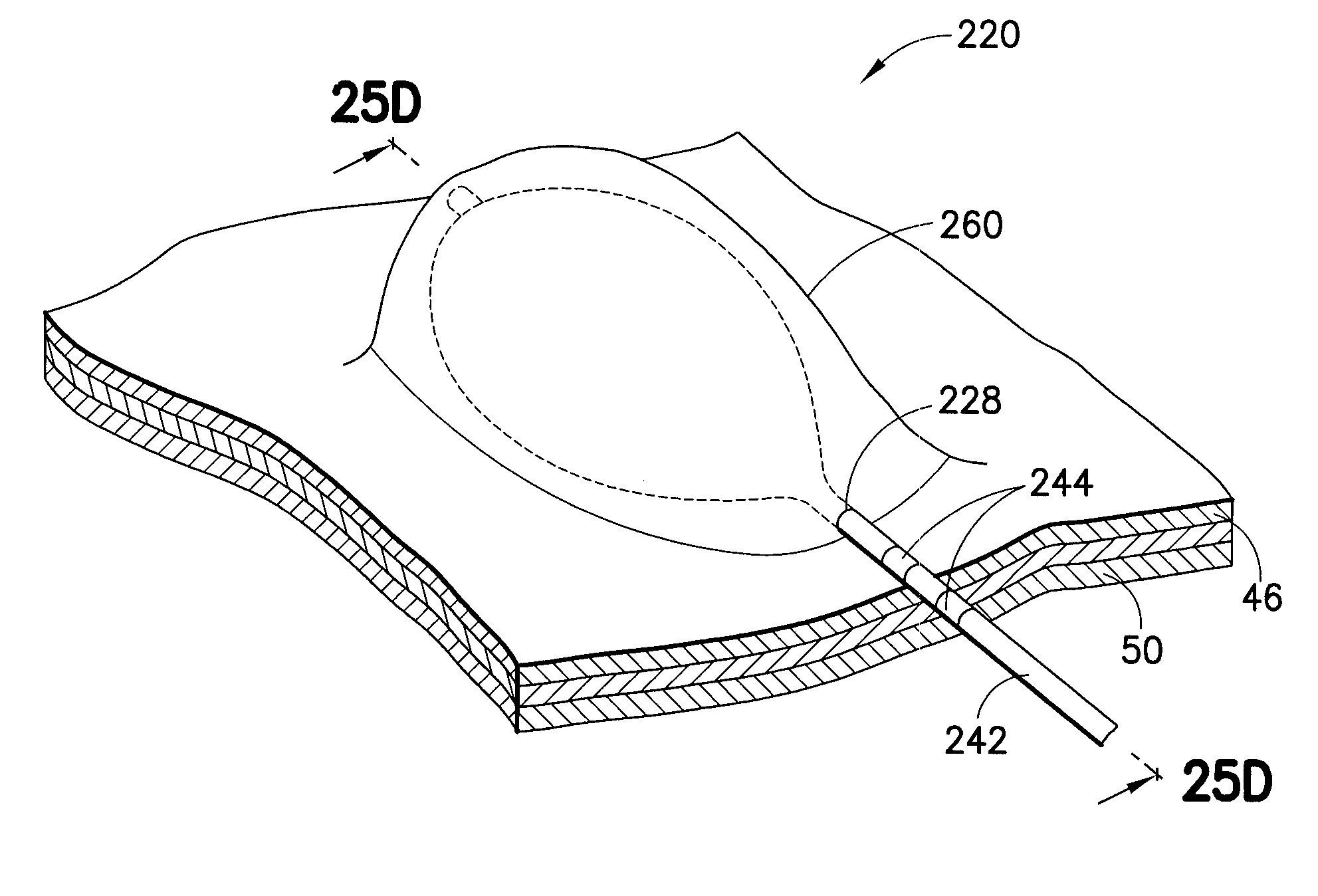 Methods and systems for submucosal implantation of a device for diagnosis and treatment with a therapeutic agent