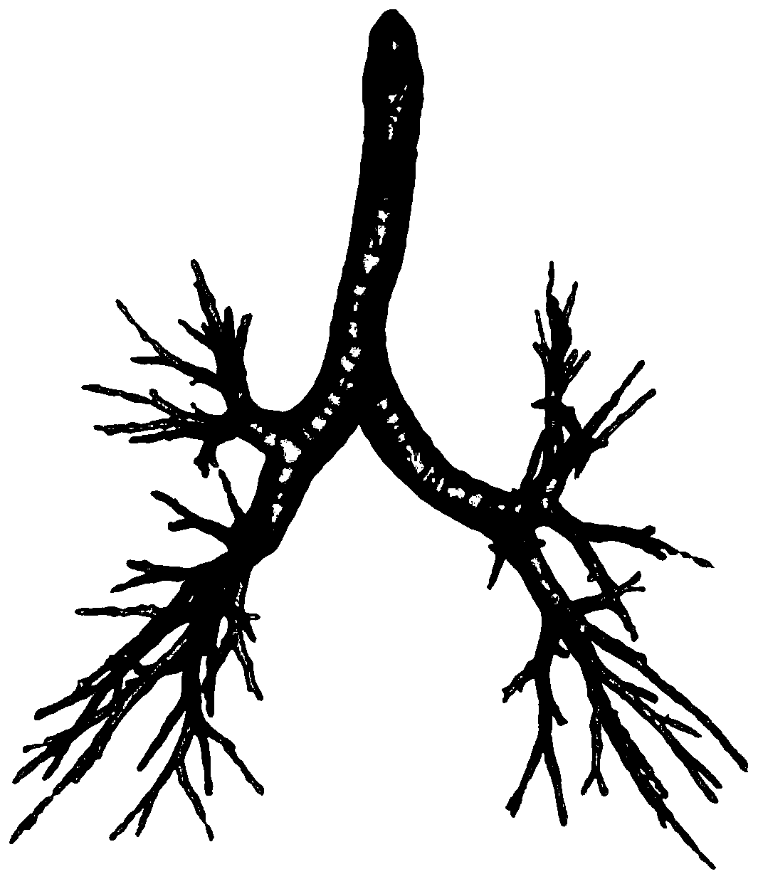 Tracheal tree full-automatic segmentation method based on differential geometry