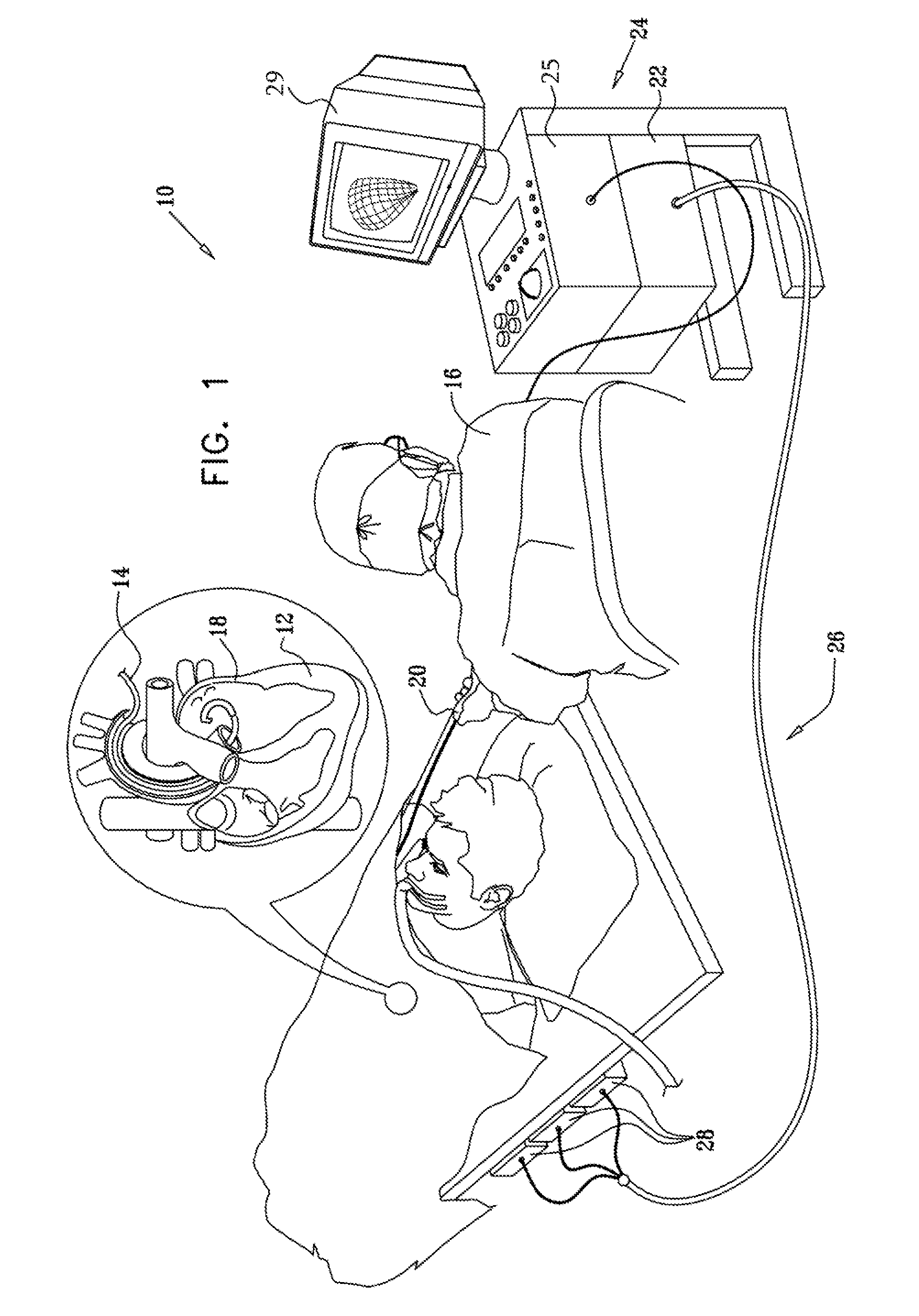 Dual-purpose lasso catheter with irrigation