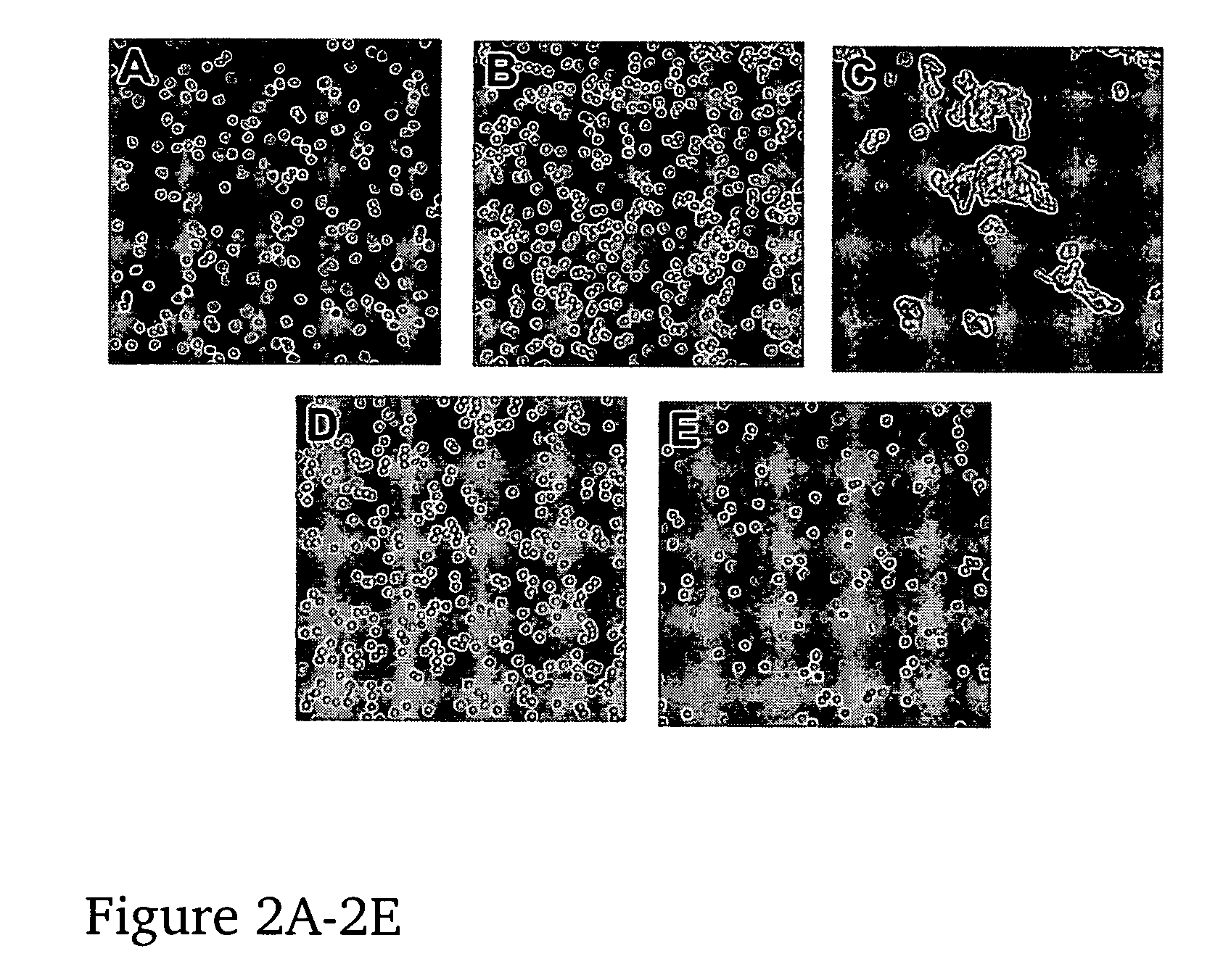 Universal red blood cells, methods of preparing same, and uses thereof