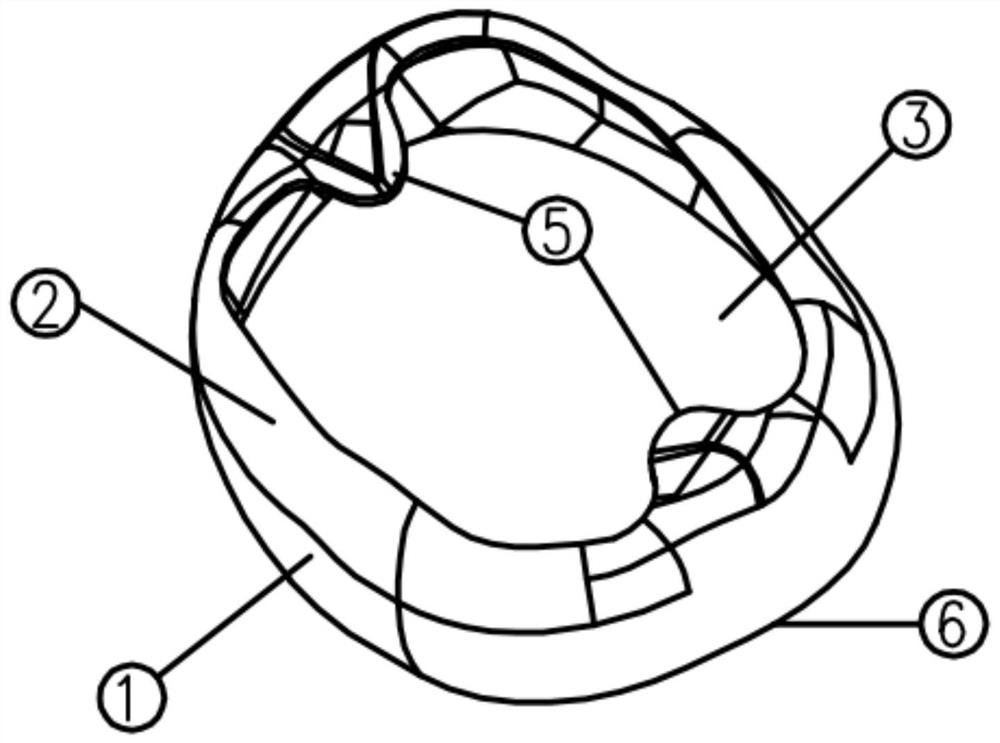 Open-face preformed dental crown and use method thereof