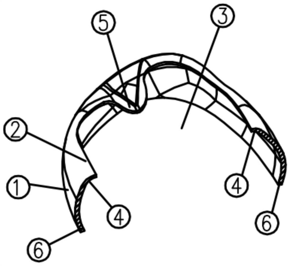 Open-face preformed dental crown and use method thereof