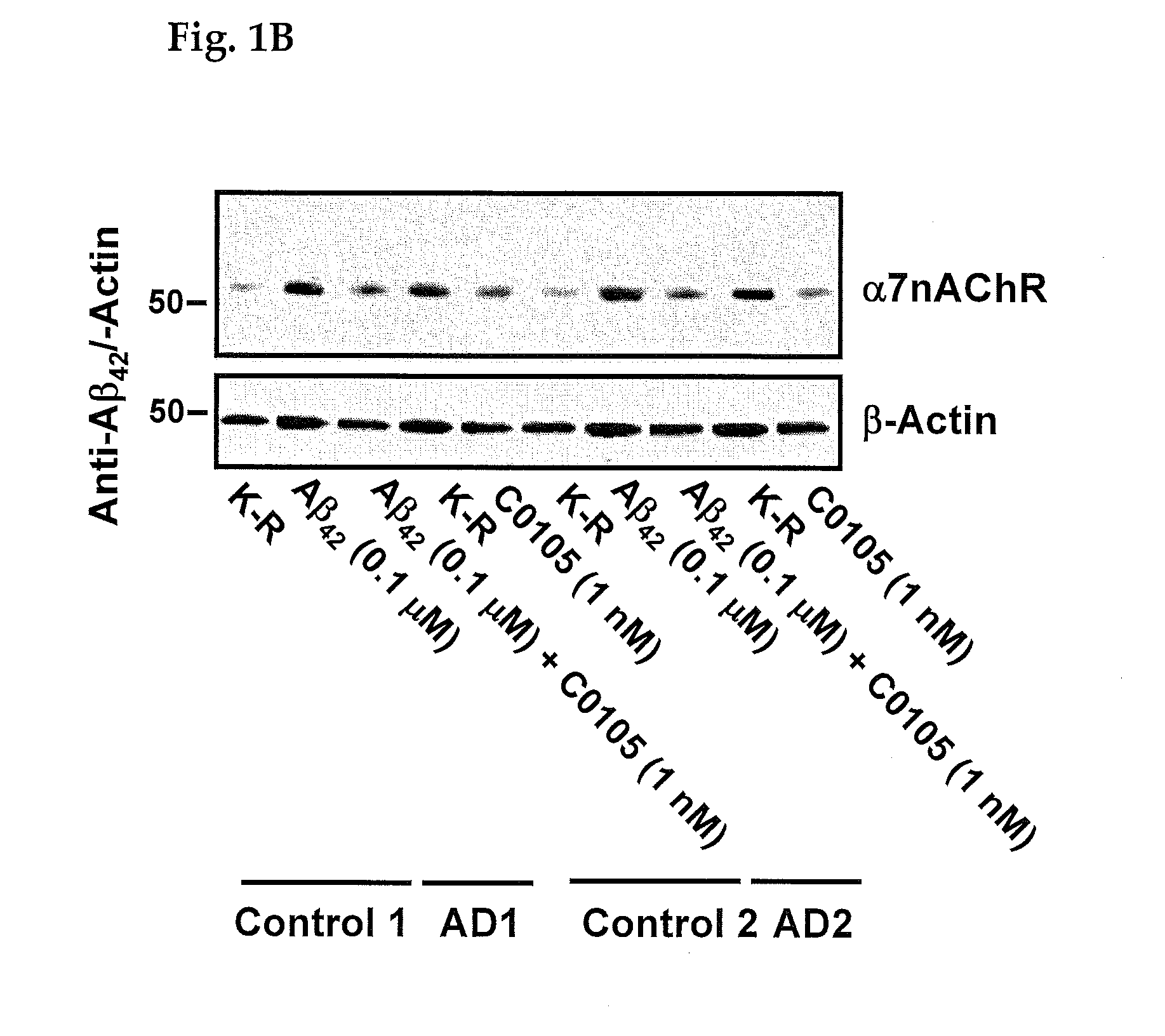 Alzheimer's disease assay in a living patient