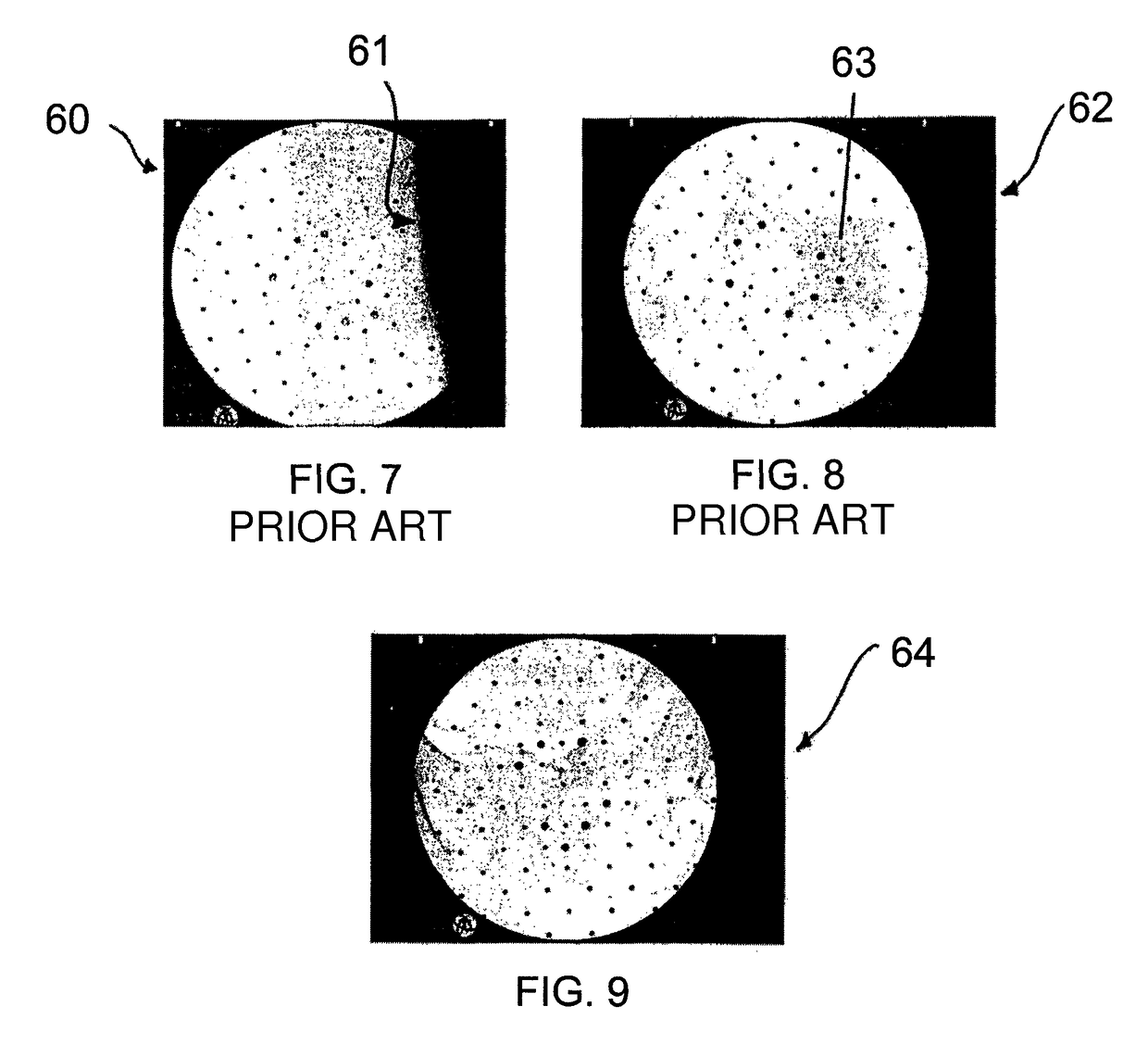 Patient lateral positioning device for pelvic treatments comprising a vacuum mattress