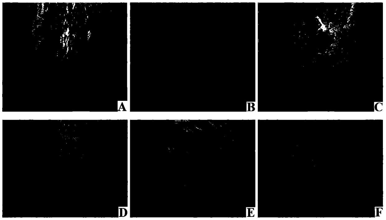 Application of Viper Venom in the Preparation of Antiangiogenic Drugs