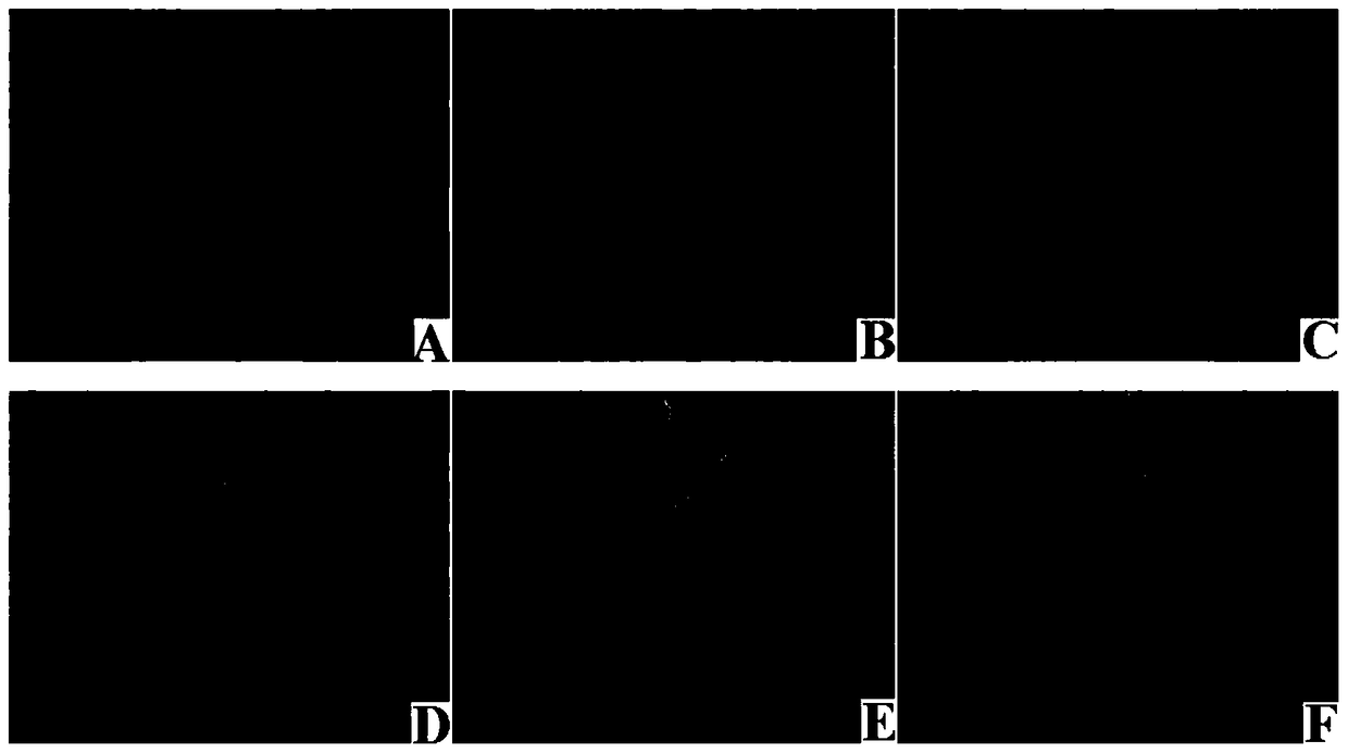 Application of Viper Venom in the Preparation of Antiangiogenic Drugs