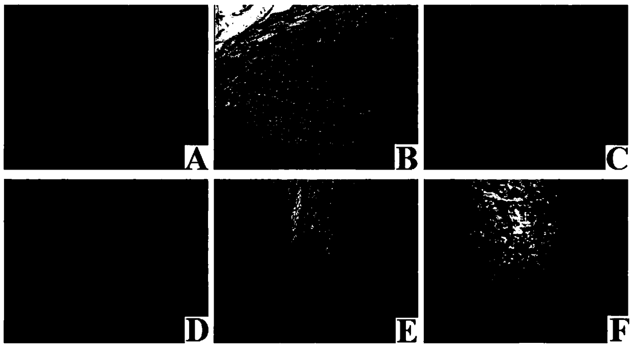 Application of Viper Venom in the Preparation of Antiangiogenic Drugs