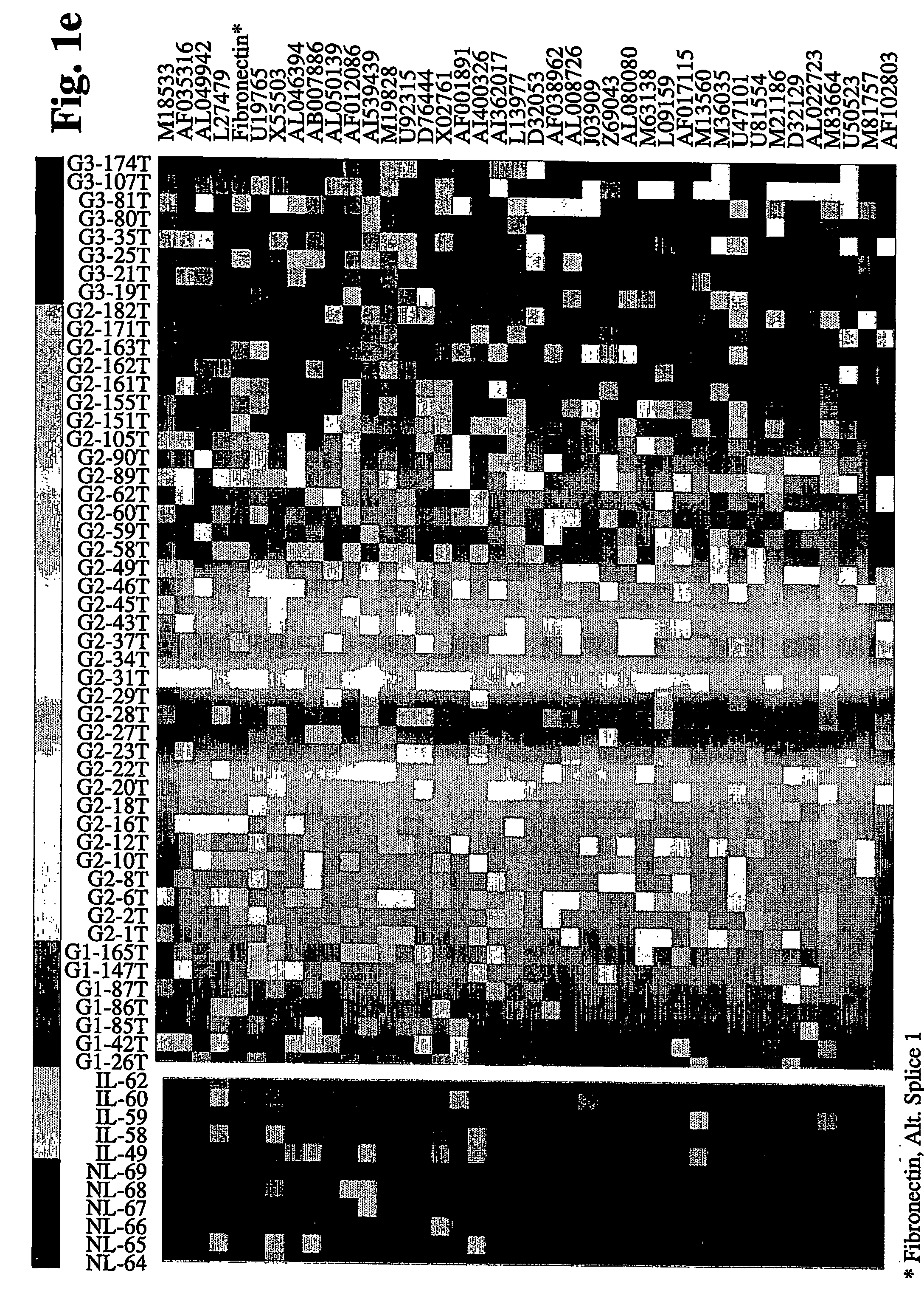 Method of Defining the Differentiation Grade of Tumor