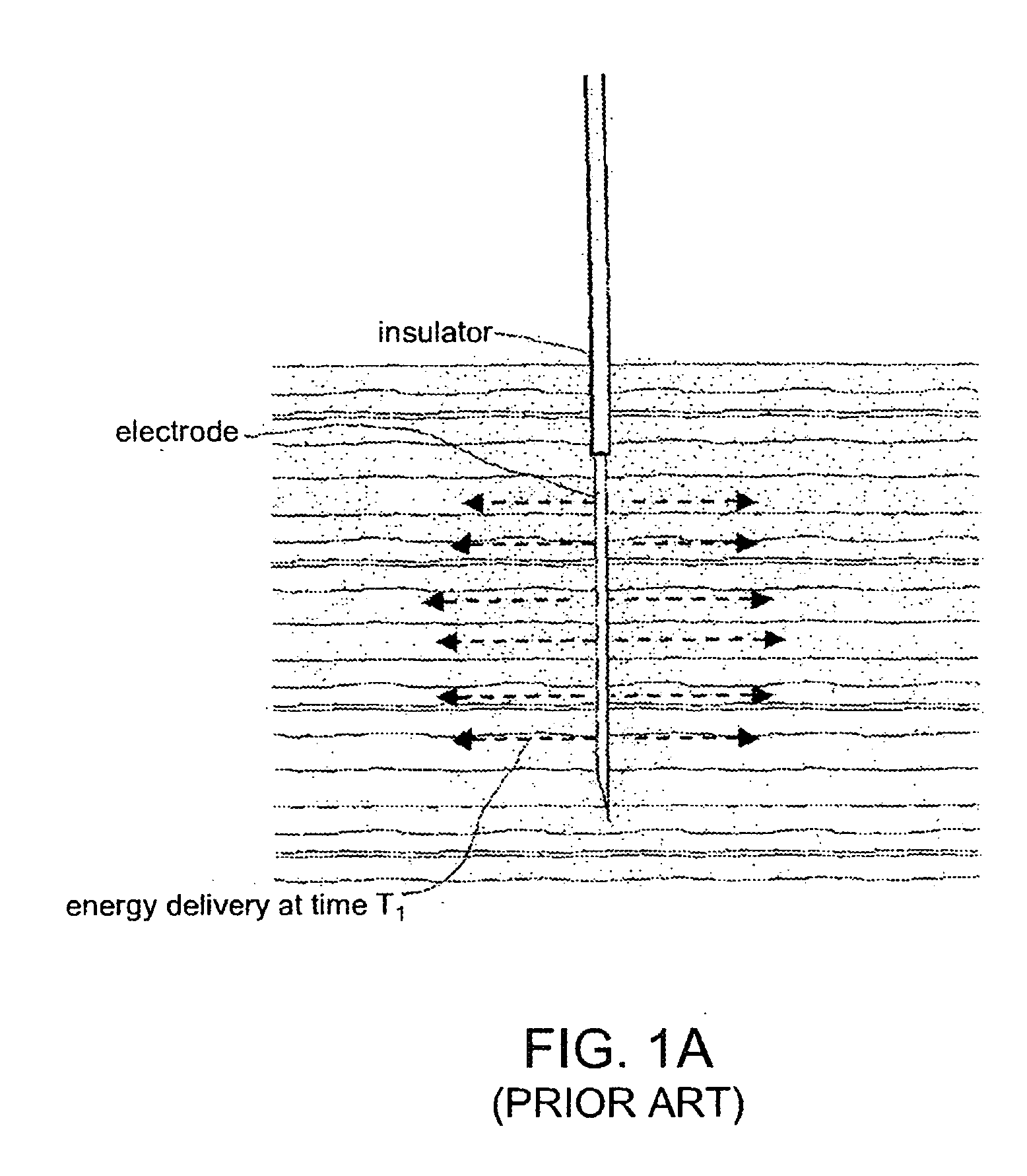 Electrosurgical working end for controlled energy delivery