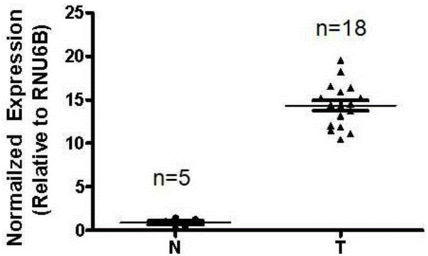 Application of long-chain non-coding RNA (ribonucleic acid) gene LOC553103 in preparation of nasopharynx cancer prognosis preparation