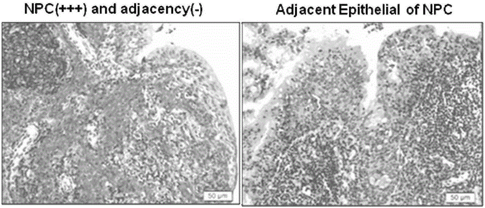 Application of long-chain non-coding RNA (ribonucleic acid) gene LOC553103 in preparation of nasopharynx cancer prognosis preparation