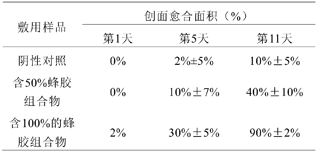 Propolis composition and instrument thereof and application thereof in wound treatment