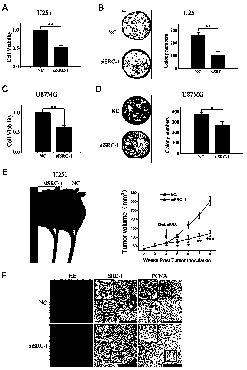 siRNA capable of knocking down expression of SRC-1 gene and application thereof