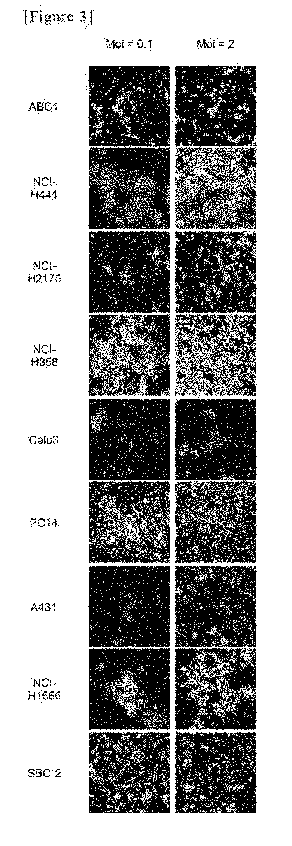 Gene-modified measles virus for tumor treatment use