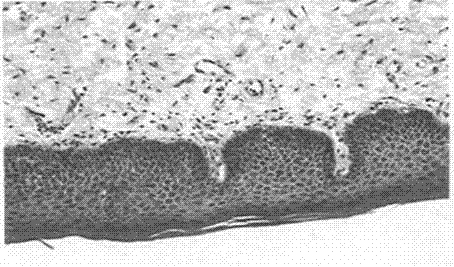 Externally used medicine for treating vulva lichen sclerosus