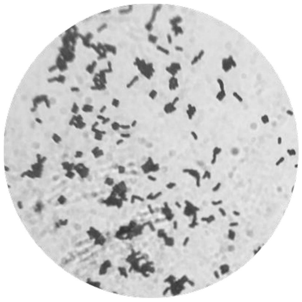 A strain of Lactobacillus plantarum nx-1 and its application in the preparation of hypoglycemic drugs