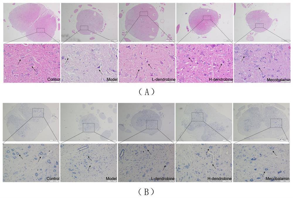 Application of dendrobium nobile alkaloid