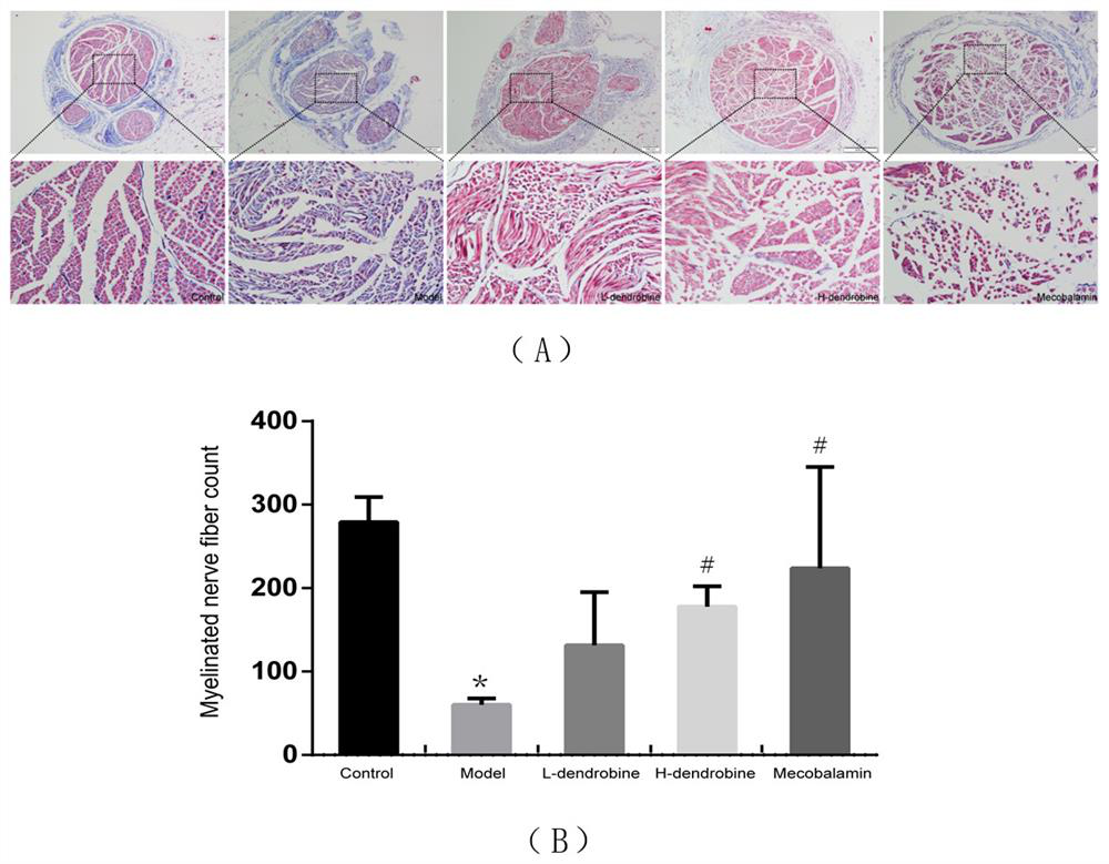 Application of dendrobium nobile alkaloid