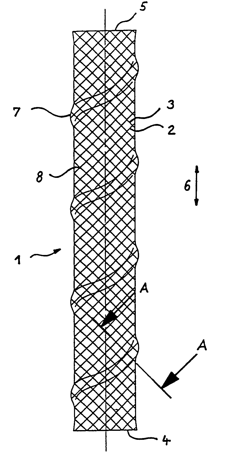 Stents with proximal and distal end elevations