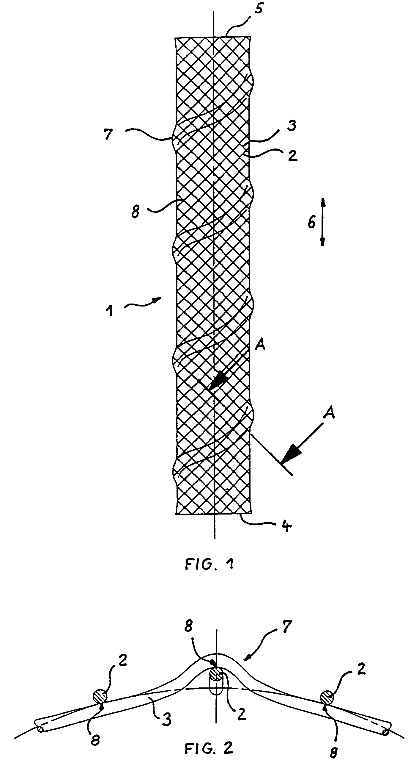 Stents with proximal and distal end elevations