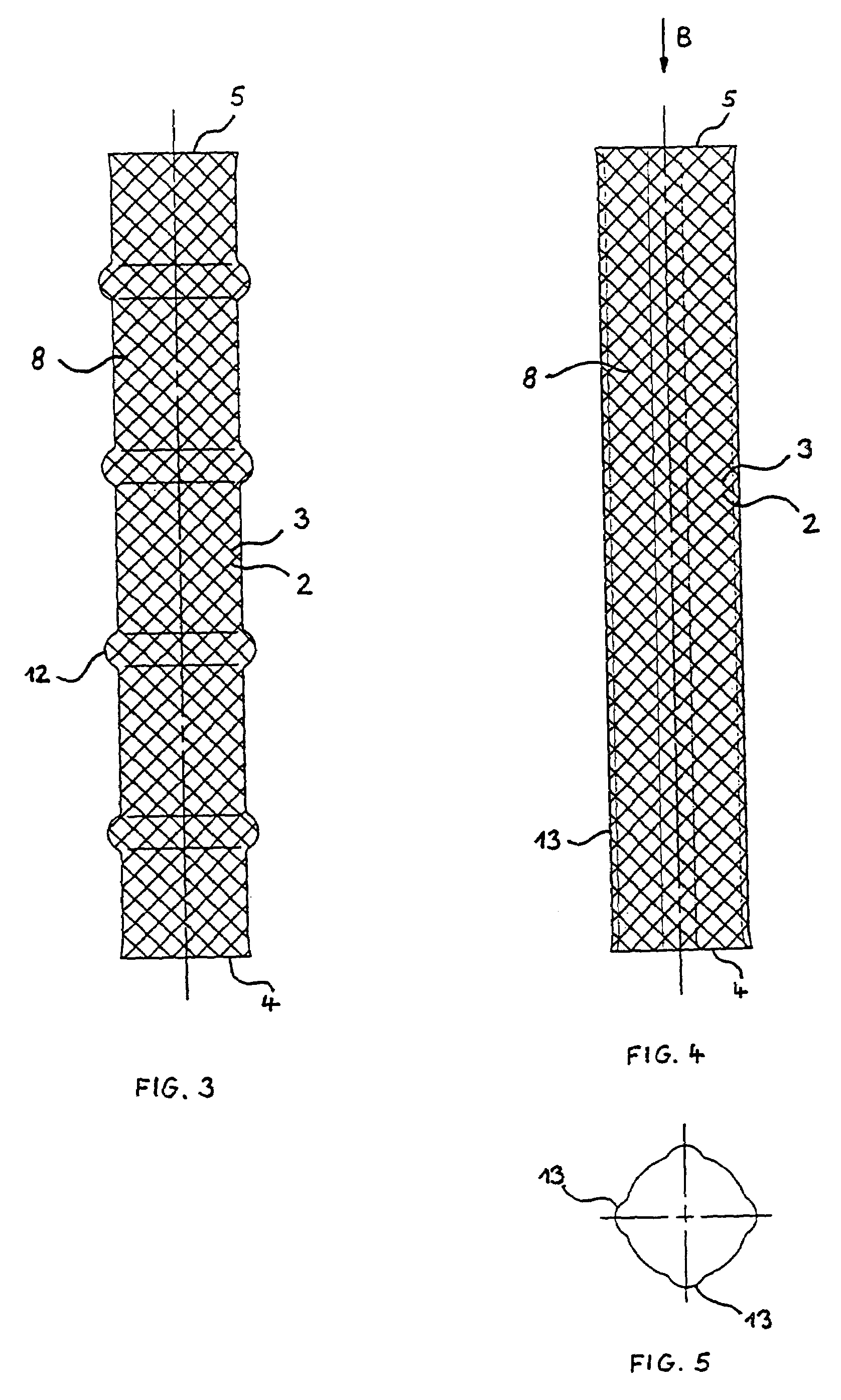 Stents with proximal and distal end elevations