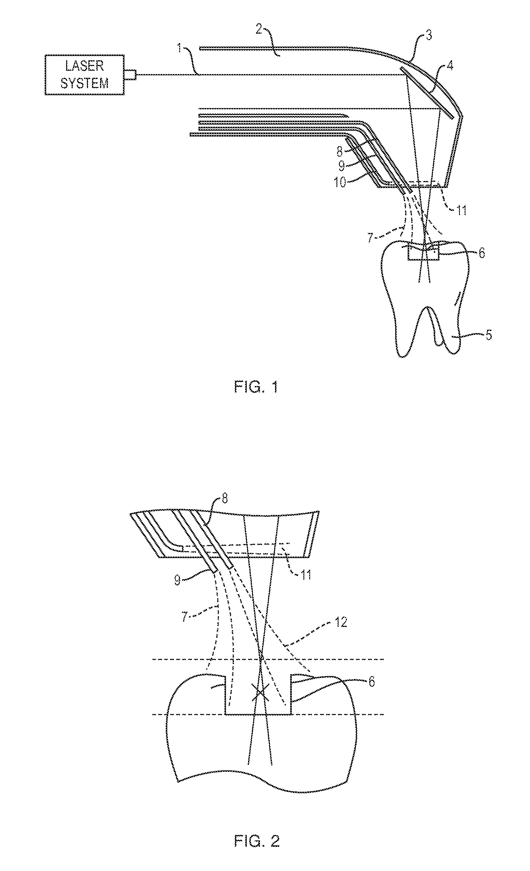 Apparatus and method for controlled fluid cooling during laser based dental treatments