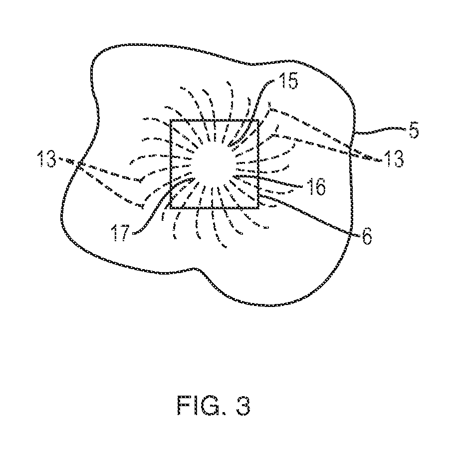 Apparatus and method for controlled fluid cooling during laser based dental treatments