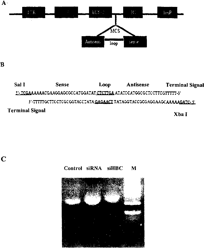 Interference RNA interfering muscle specific E3 ubiquitin protein ligase gene, carrier containing same and application thereof