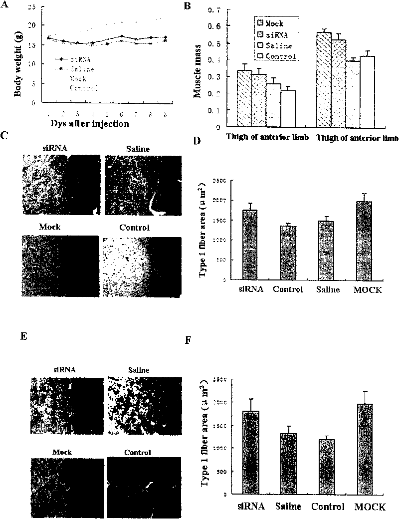 Interference RNA interfering muscle specific E3 ubiquitin protein ligase gene, carrier containing same and application thereof