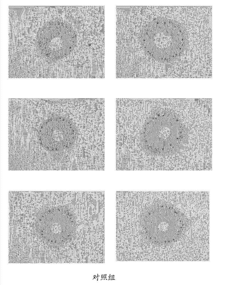 Medical device for placement into a lumen and manufacturing method thereof